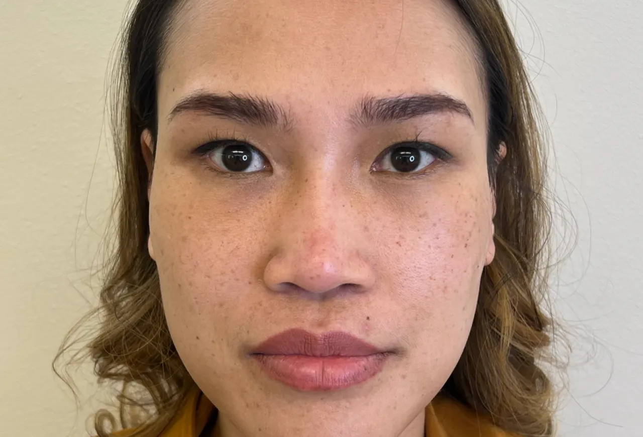 Ansiktskonturering Anti-age resultat 4