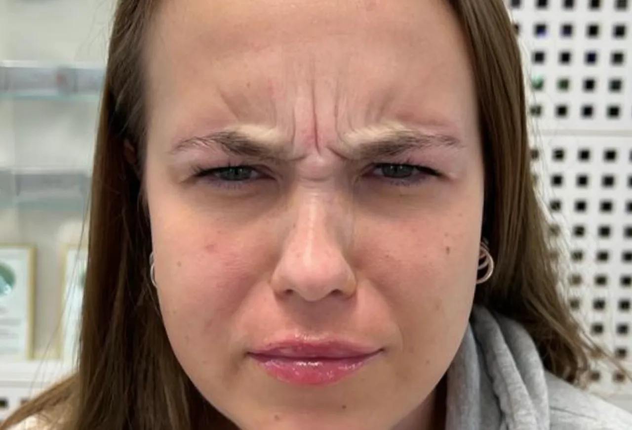 Arya Rynkbehandling resultat 3