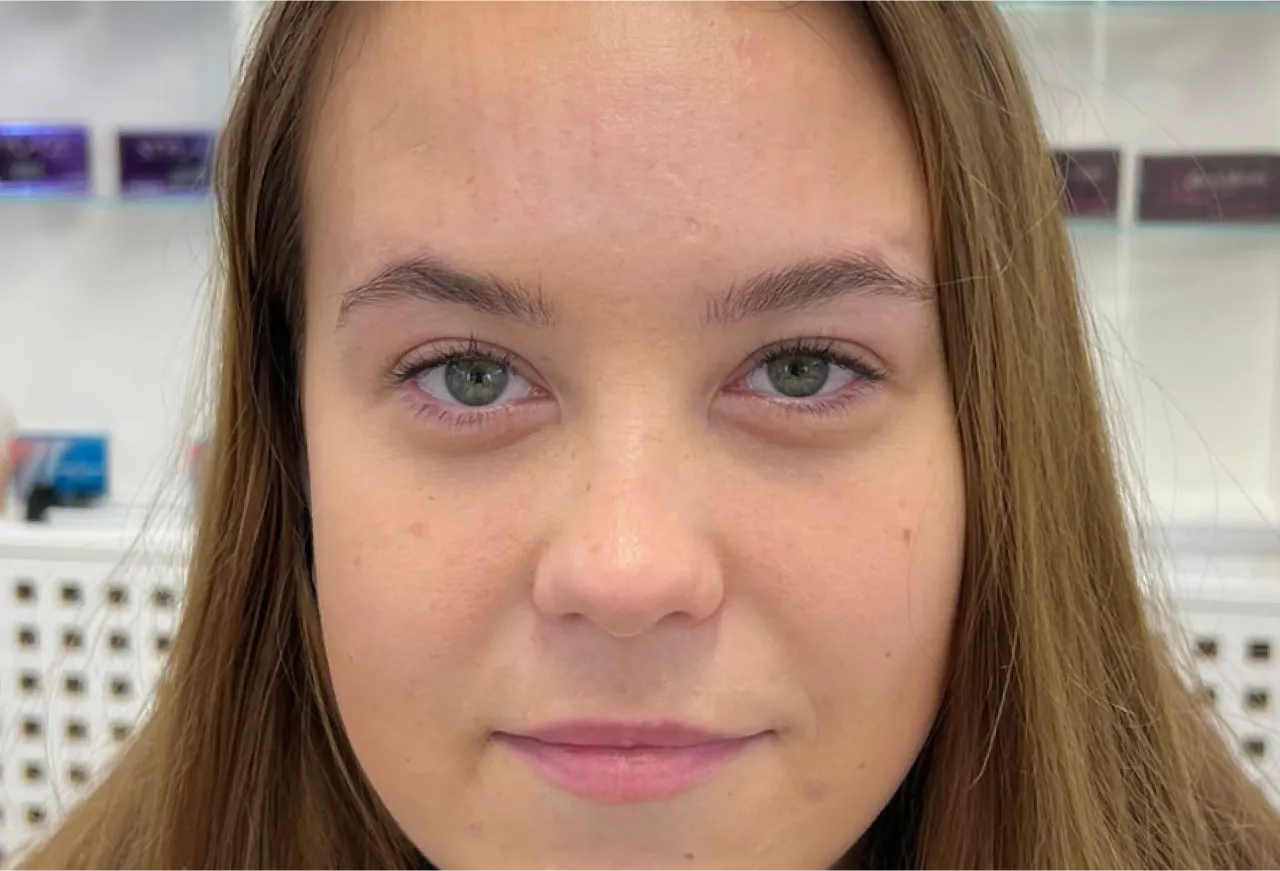 Pannrynkor resultat 3
